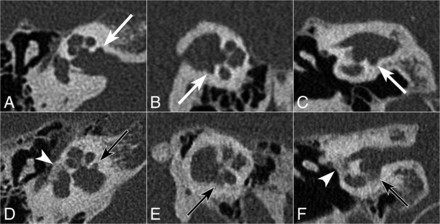 Fig 3.