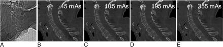 Fig 3.