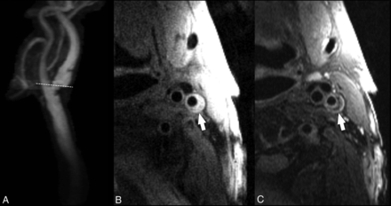 Fig 8.