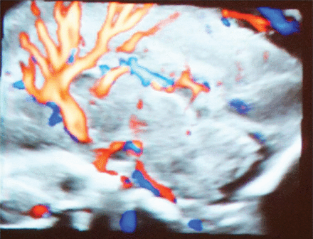 Fig 12.