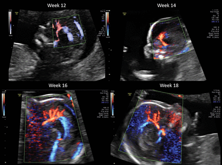Fig 4.