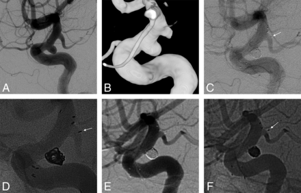 Fig 3.