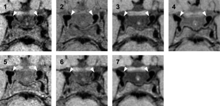 Fig 2.
