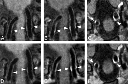 Fig 5.