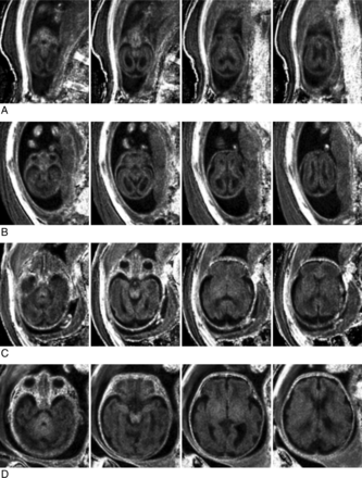 Fig 4.