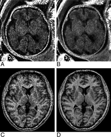Fig 6.