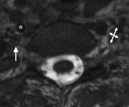 Fig 2.