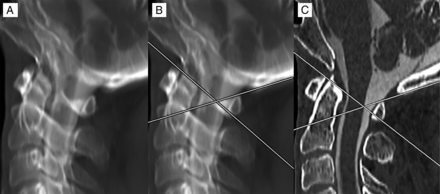 Fig 2.