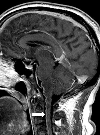 Fig 2.