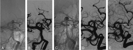 Fig 2.