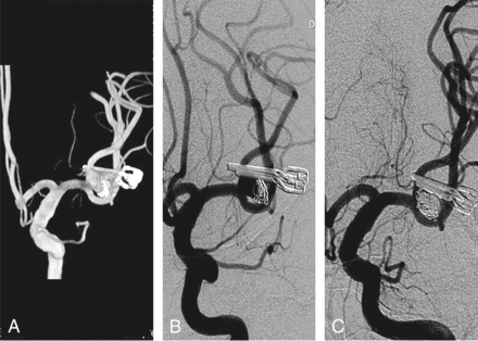 Fig 3.