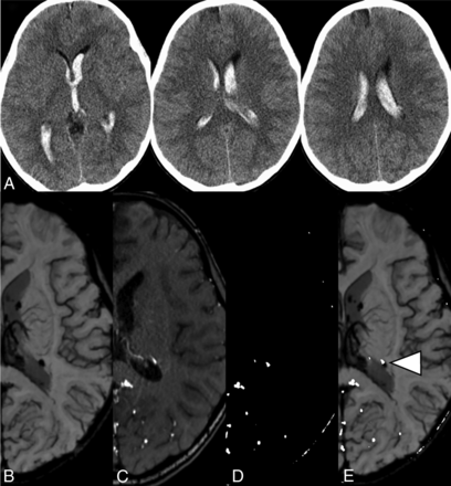 Fig 3.