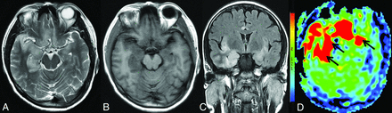 Fig 3.