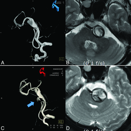 Fig 4.