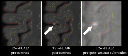 Fig 1.