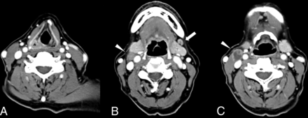 Fig 1.