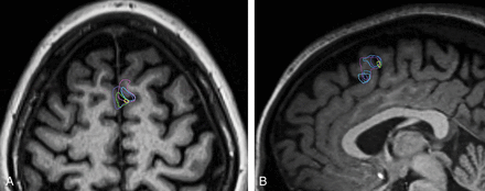 Fig 4.