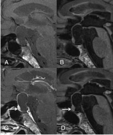 Fig 4.