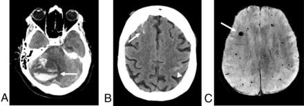 FIG 1.