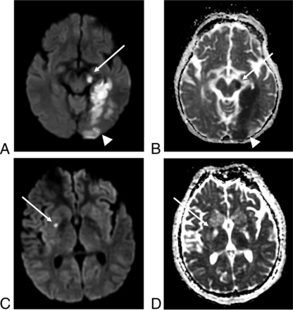 FIG 2.