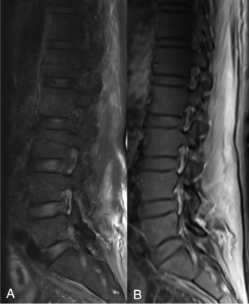 FIG 1.