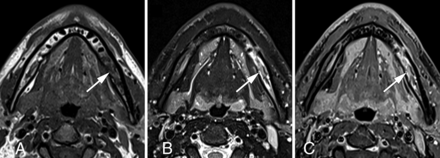 FIG 13.