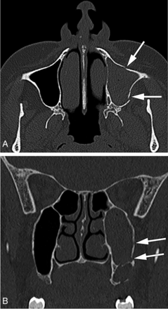 FIG 14.
