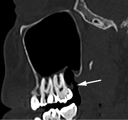 FIG 15.