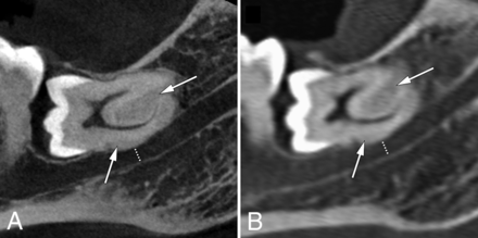 FIG 2.