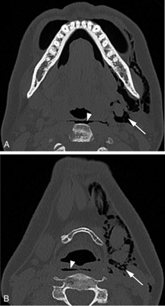 FIG 20.