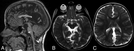 FIG 4.