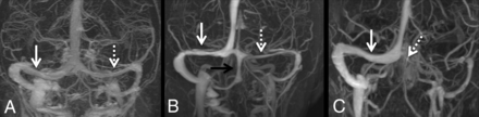 FIG 2.