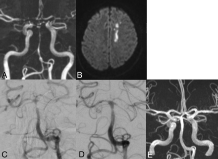FIG 2.