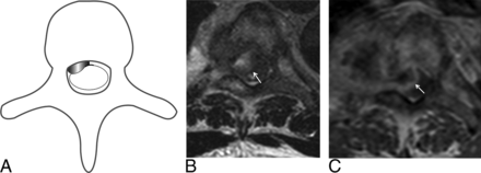 FIG 2.