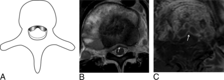 FIG 3.