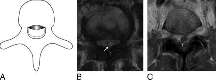 FIG 4.