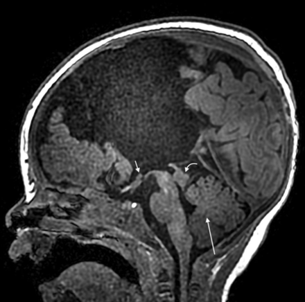Fig 4.