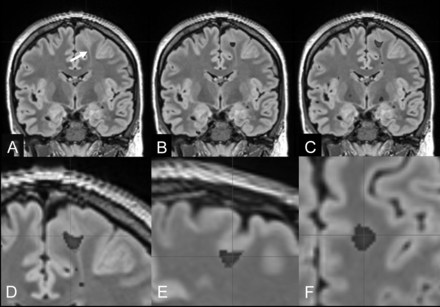 Fig 4.
