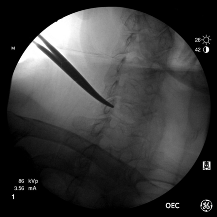 Fig 4.