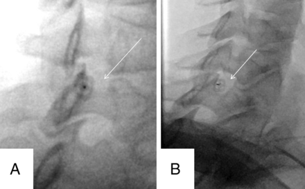 Fig 5.