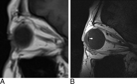 Fig 1.