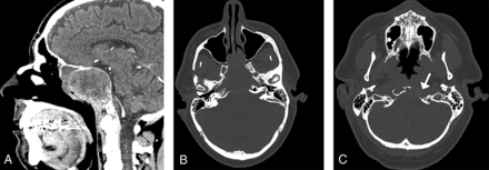 FIG 1.