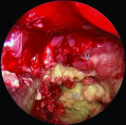 FIG 3.