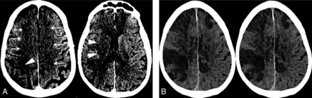 FIG 1.