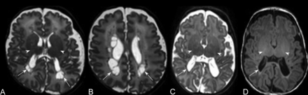 Fig 3.