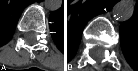 FIG 2.