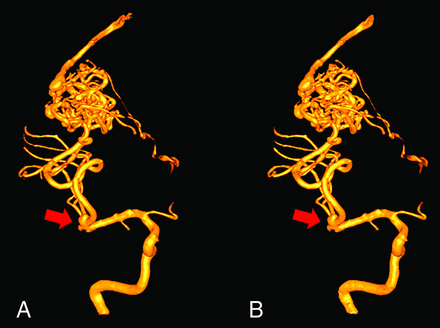 FIG 3.