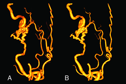 FIG 4.