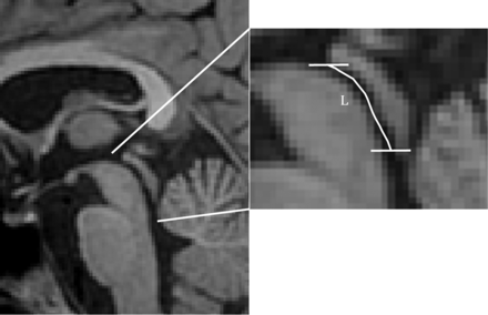 FIG 2.