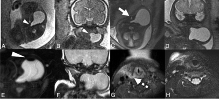 FIG 4.